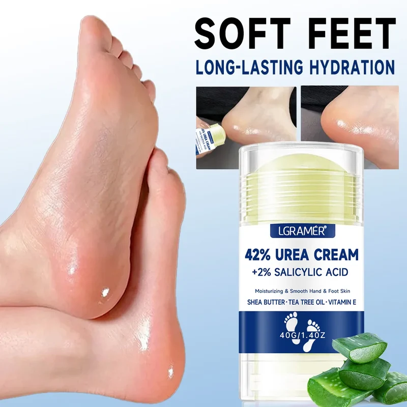 Creme para os pés com 42% de ureia + 2% de ácido salicílico. Hidratação intensiva para os pés e mãos. Creme hidratante para os pés e mãos.