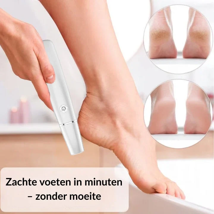 SilkySole™ – Sofort seidig glatte Füße