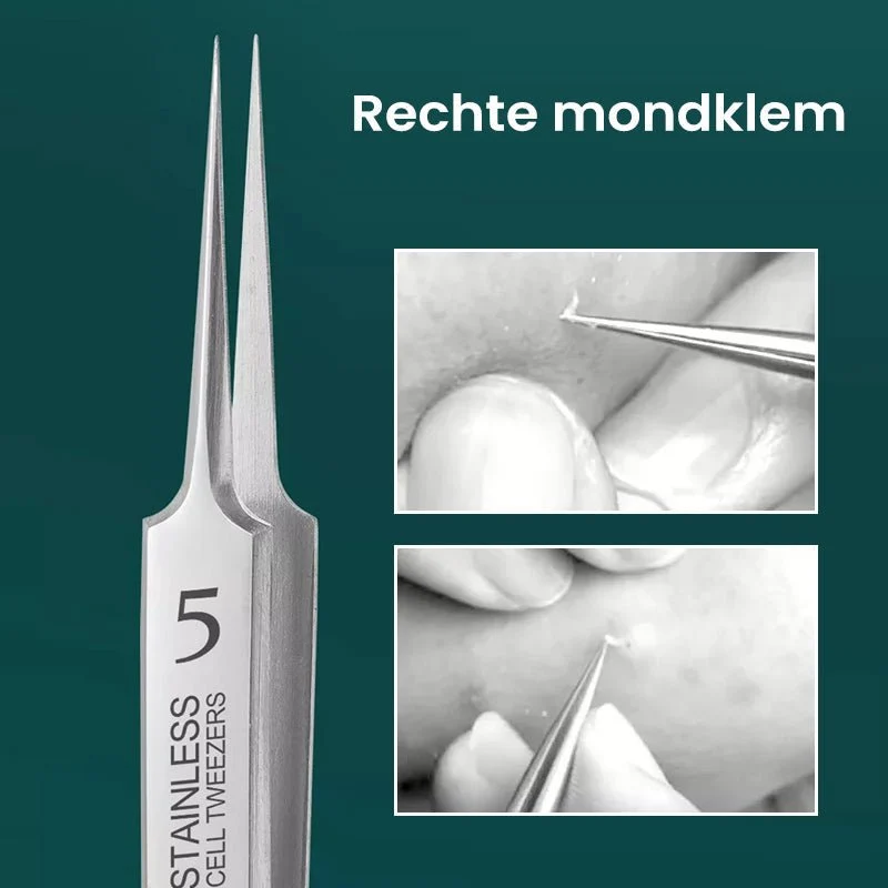 HautGreif Zielgerichtete Pickelentfernung
