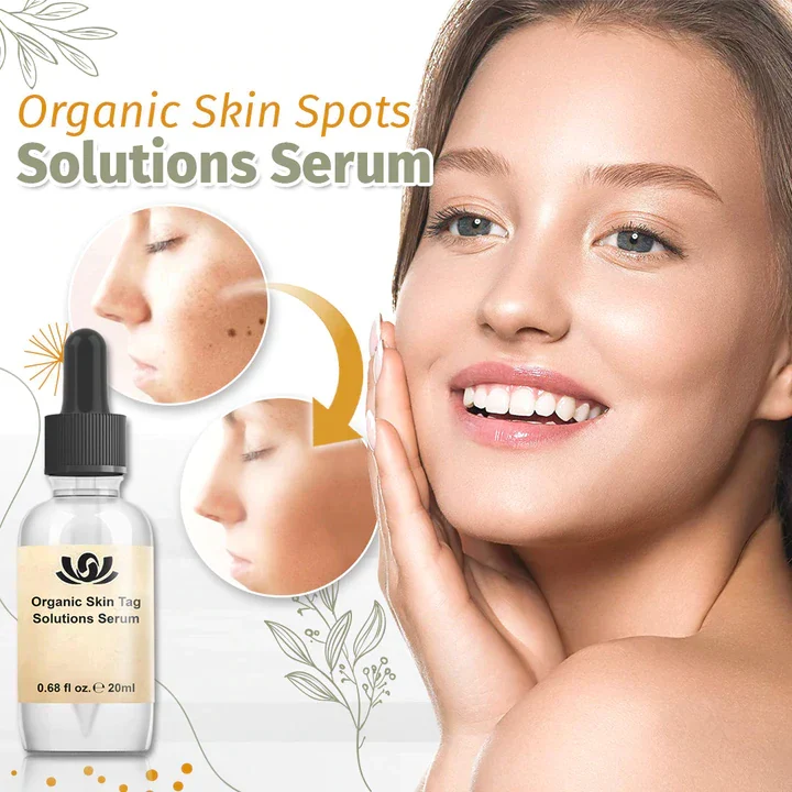 Hautflecken Serum mit pflanzlicher Formel | Für ebenmäßiger wirkende Haut | Morgens & abends anwendbar