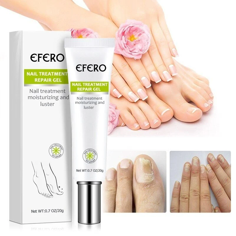 Nail fix™ | Schnelle und effektive Ergebnisse!